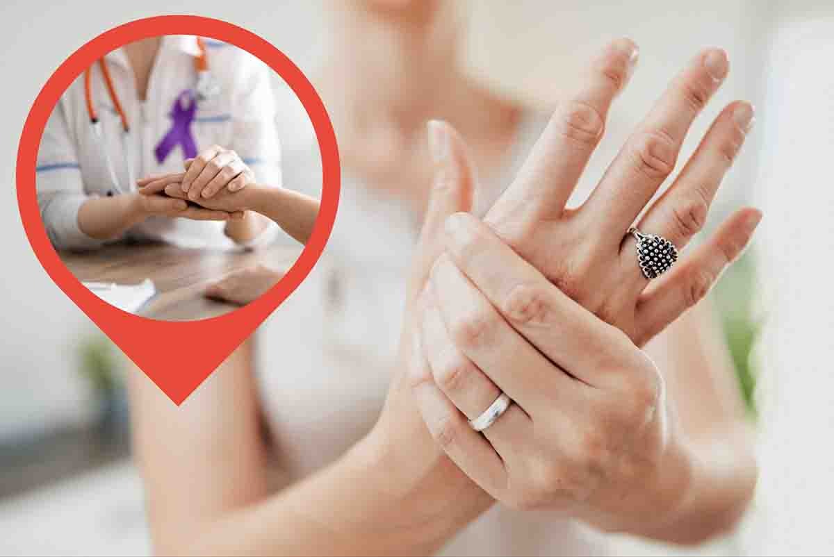 Cancro, come riconoscerlo guardando le mani